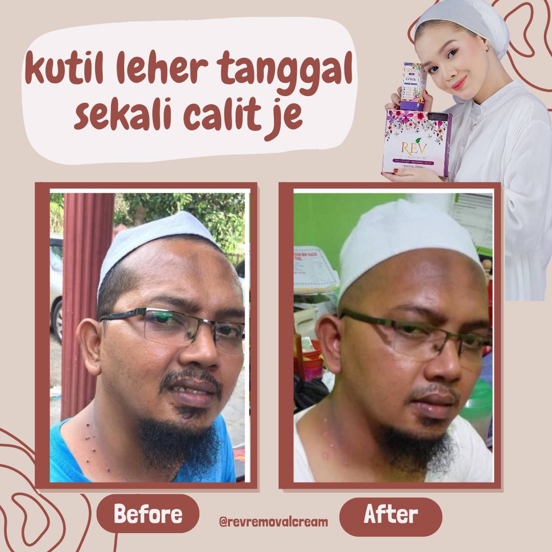 revcare-testimoni-img-1