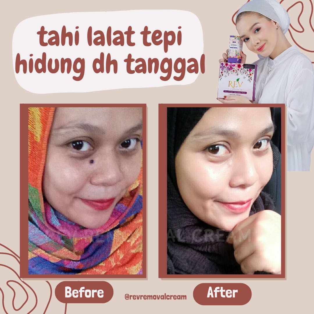 revcare-testimoni-img-10