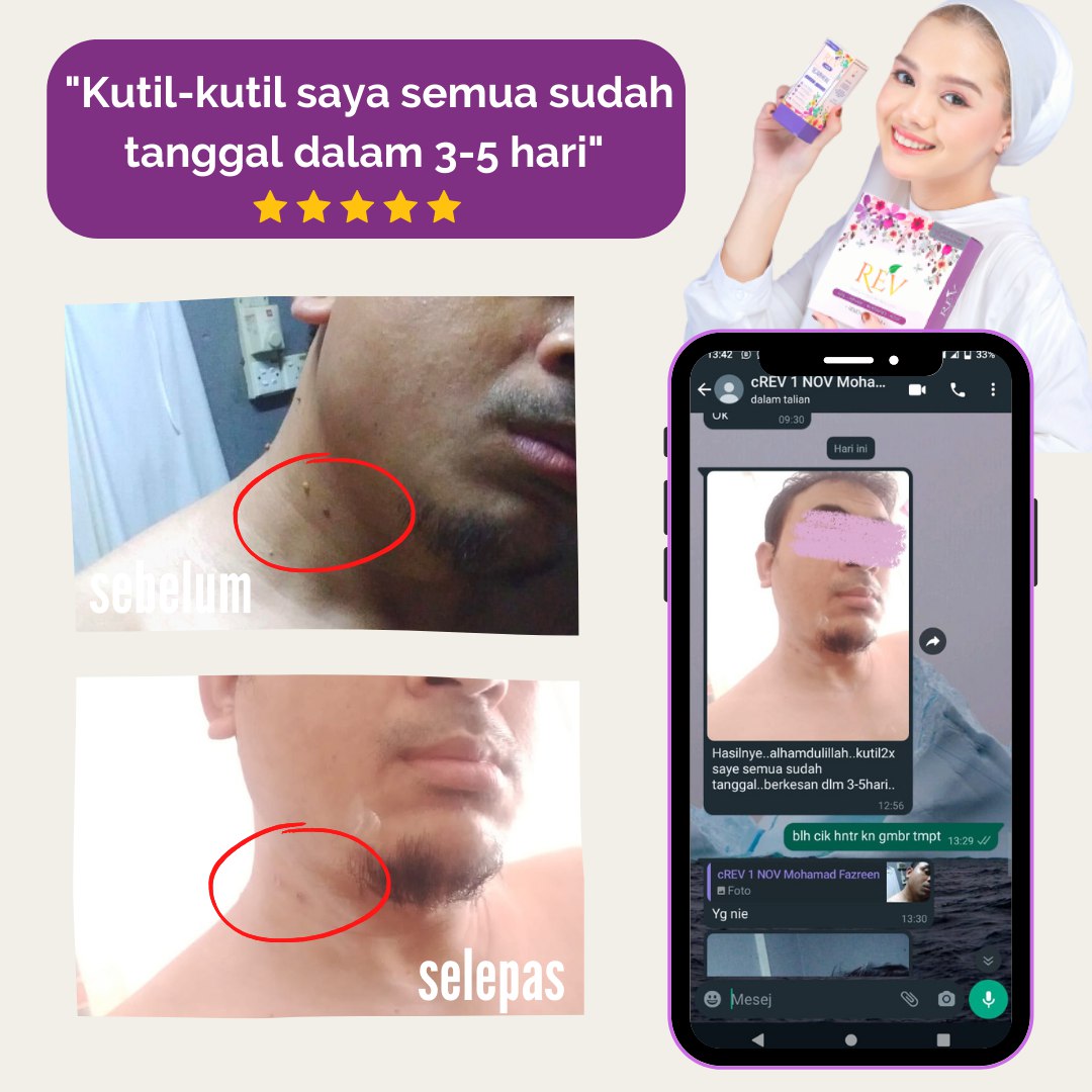 revcare-testimoni-img-11