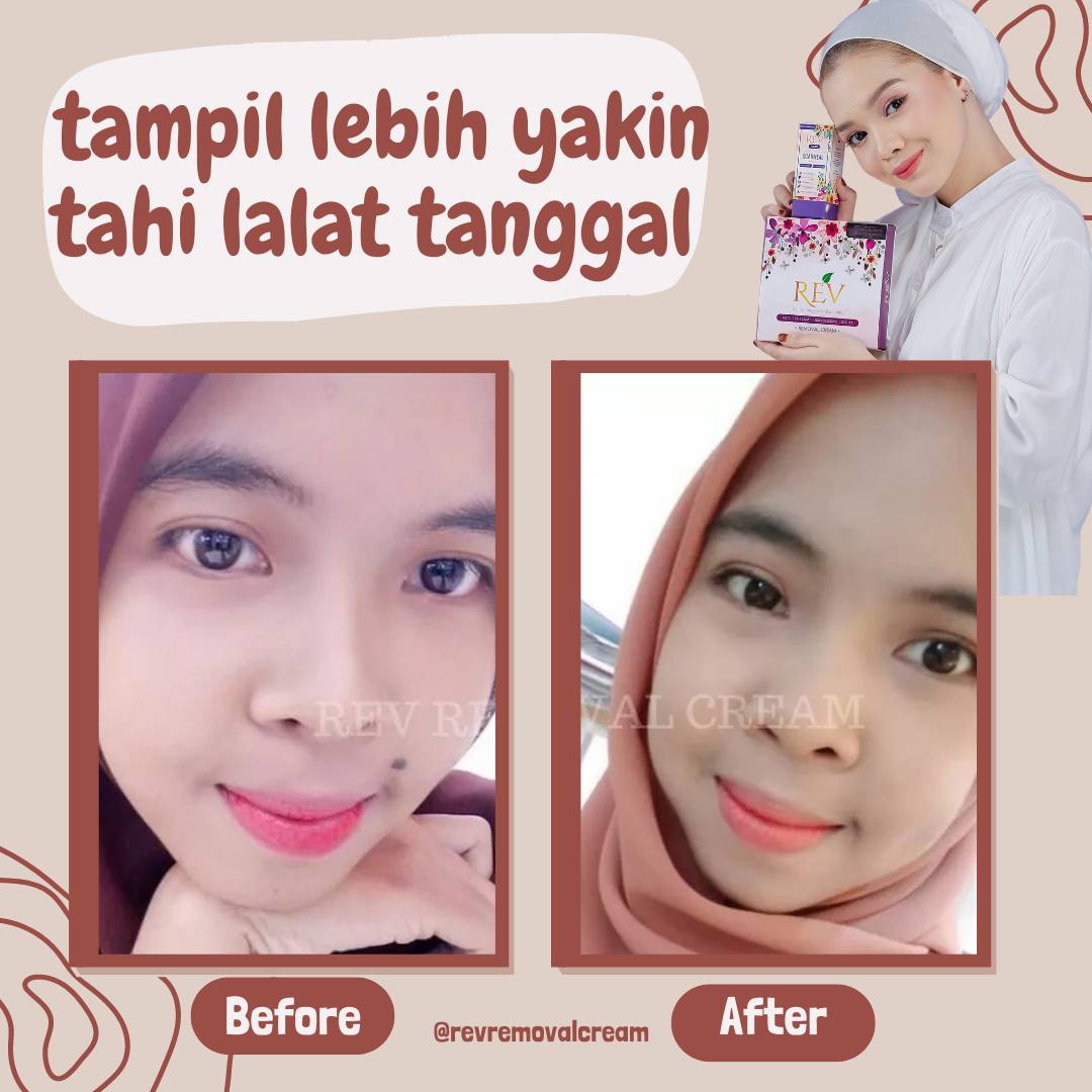revcare-testimoni-img-2