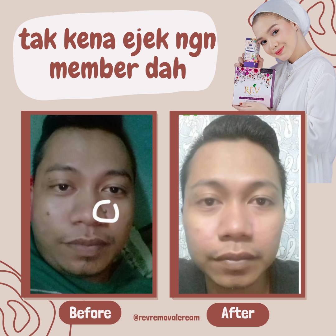 revcare-testimoni-img-3