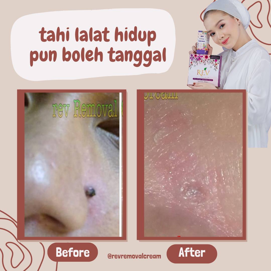 revcare-testimoni-img-4