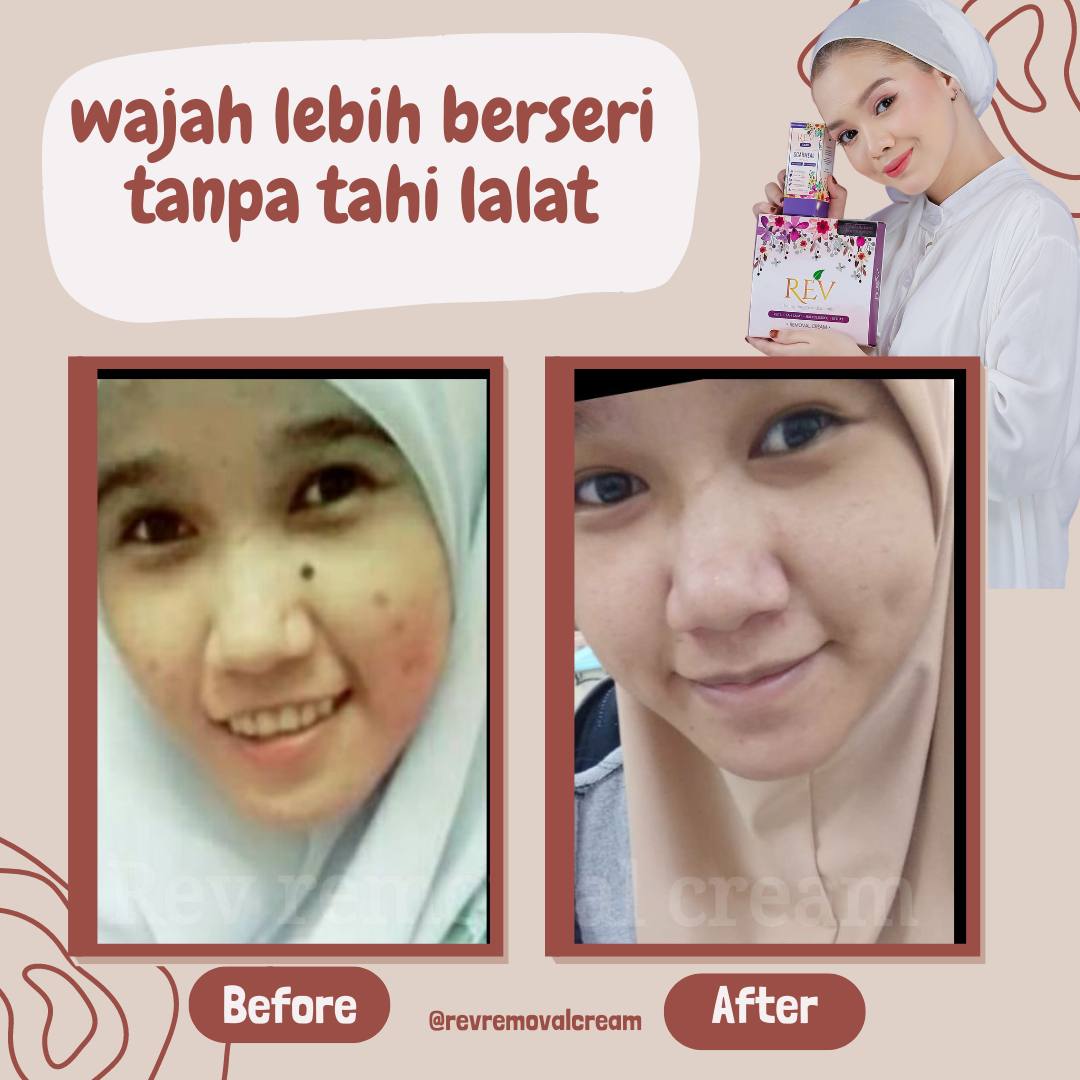 revcare-testimoni-img-5