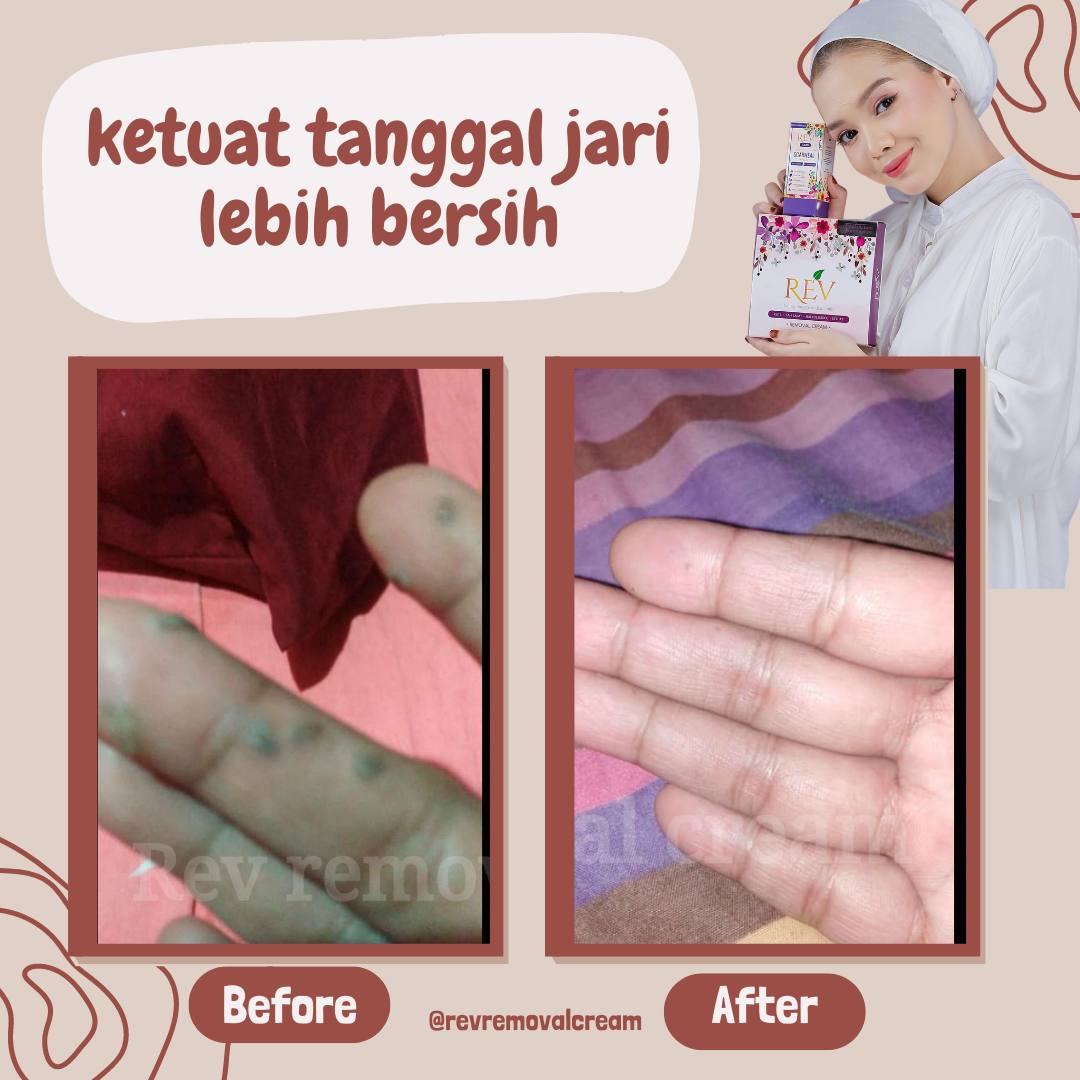 revcare-testimoni-img-6