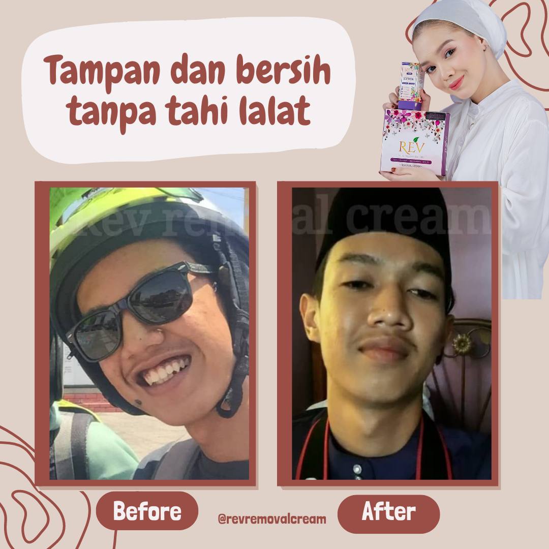 revcare-testimoni-img-7