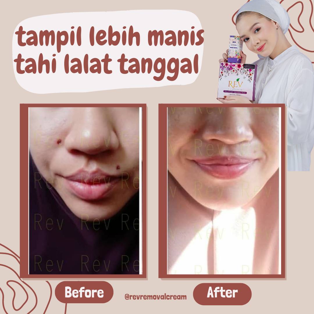 revcare-testimoni-img-8
