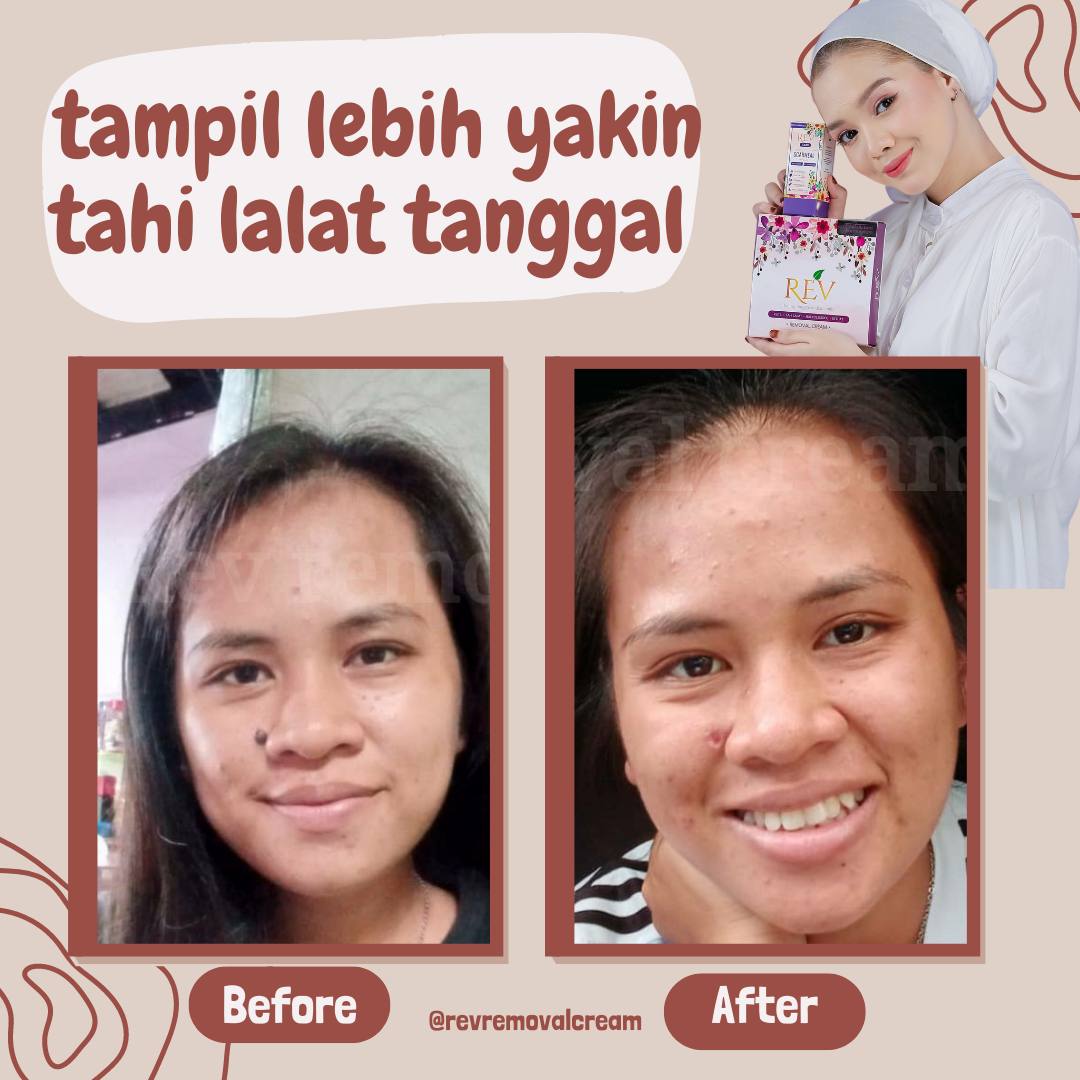 revcare-testimoni-img-9